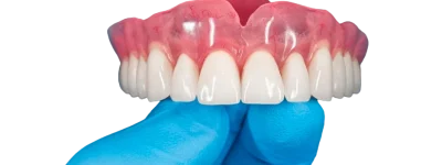 proteses-dentarias-supurior